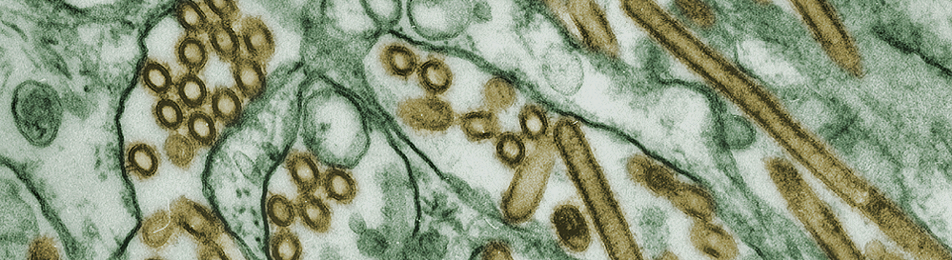 leaky gut 101: a simple guide to the gut barrier. image