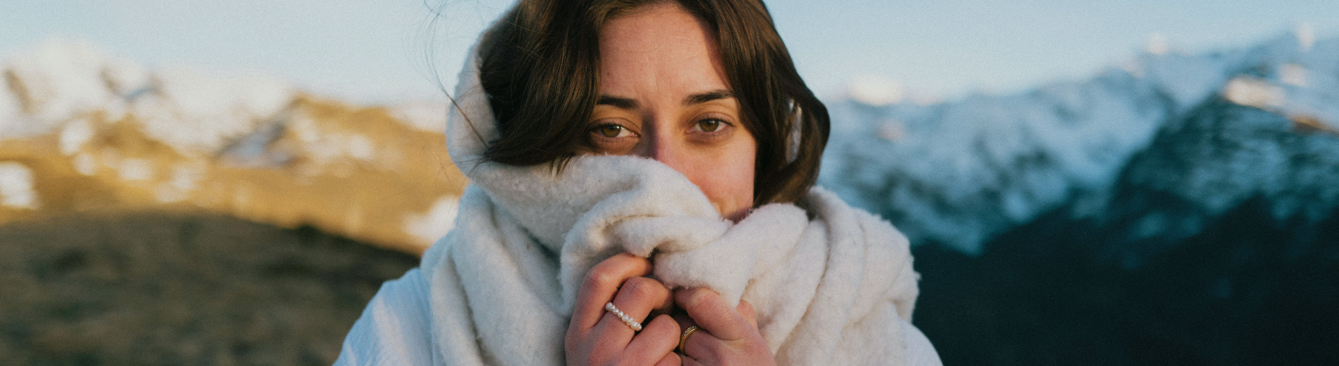 the winter flare phenomenon: why your skin suffers in the cold. image